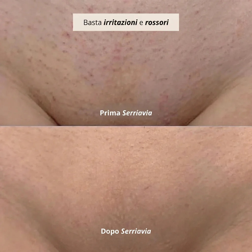 SerriaSoft™ — Rasoio Elettrico 2-in-1