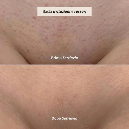 SerriaSoft™ — Rasoio Elettrico 2-in-1