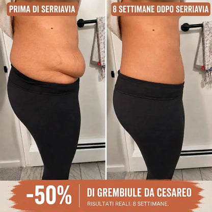 Mutandina Modellante a Compressione 360°, Anti-Diastasi